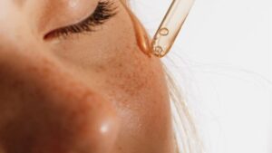 علاج تصبغات الوجه والكلف القديم